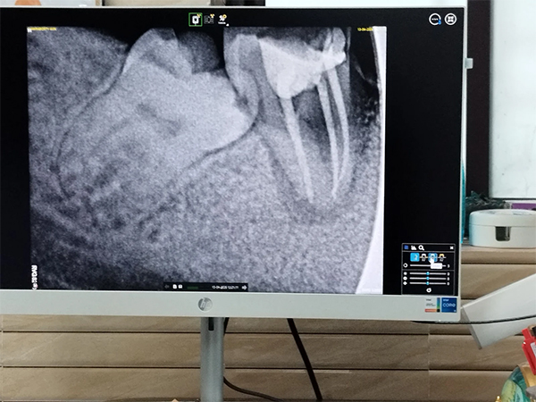 32 Not Out Multispeciality Dental Clinic